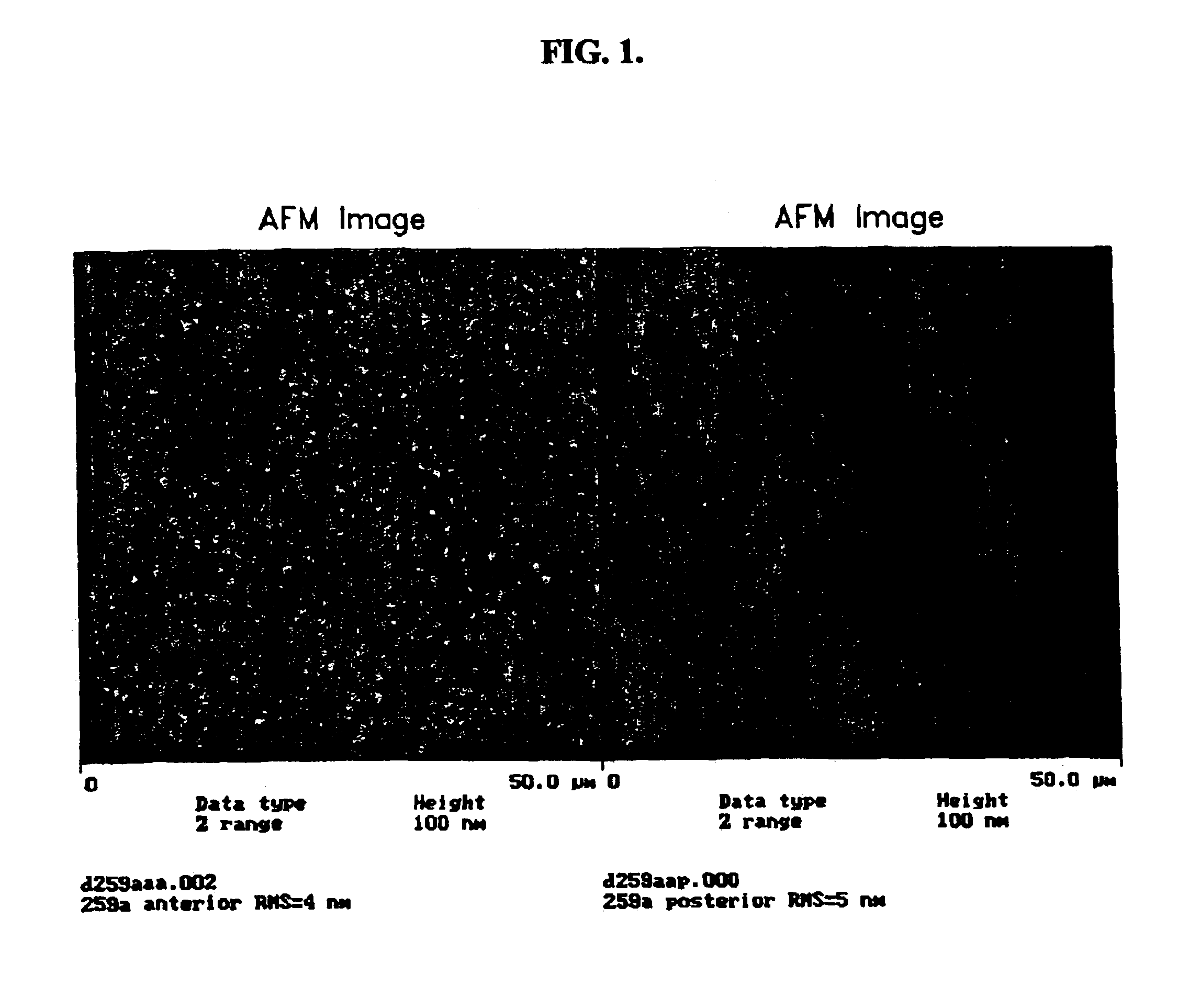 Surface treatment for silicone hydrogel contact lenses comprising hydrophilic polymer chains attached to an intermediate carbon coating