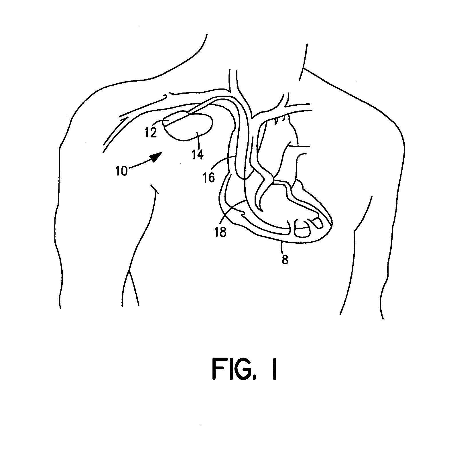 Method and system for transferring and storing data in a medical device with limited storage and memory