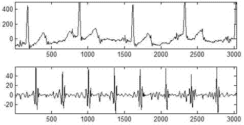 Fetal electrocardiogram signal extracting method based on wavelet threshold denoising