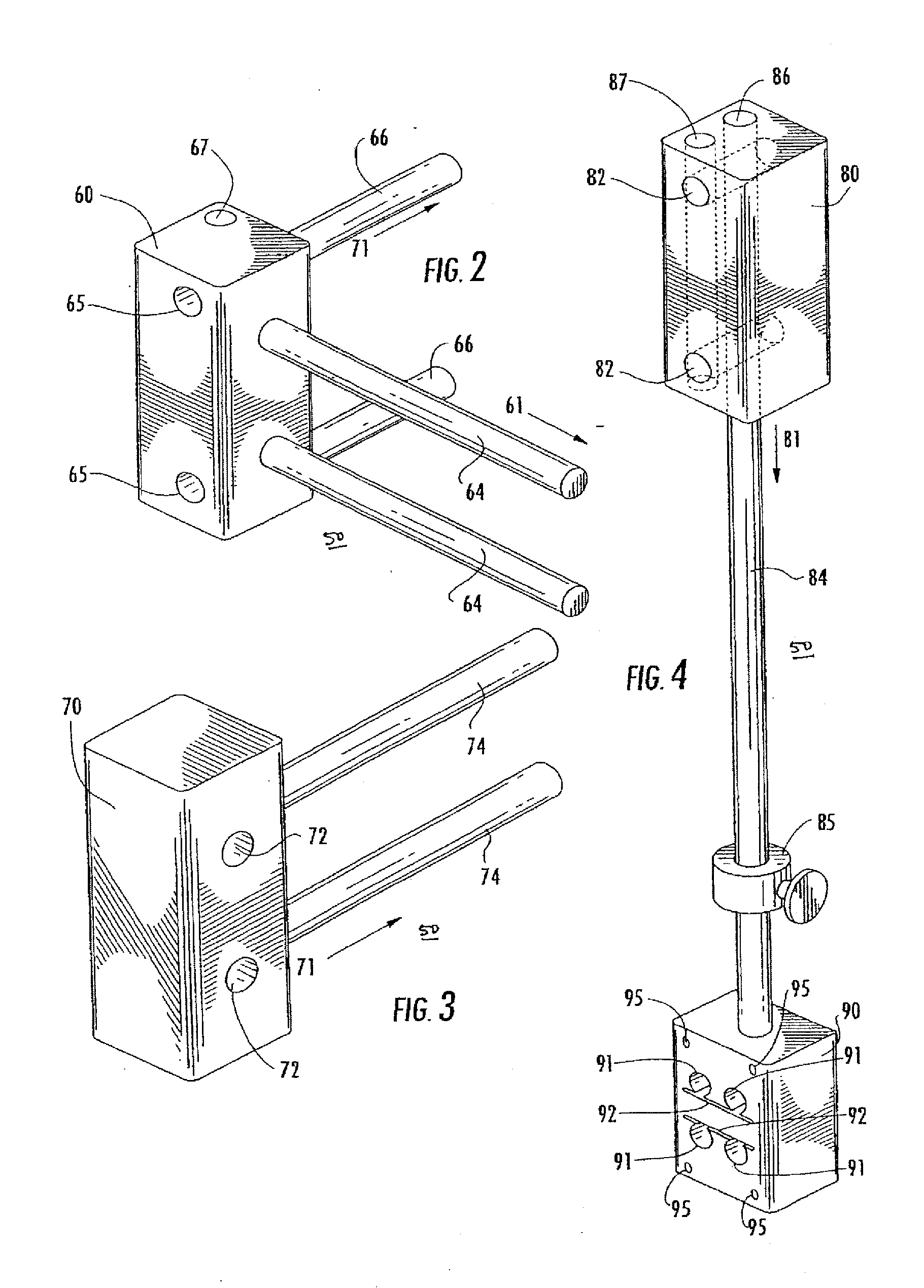 Method of Preparing an Ankle Joint for Replacement, Joint Prosthesis, and Cutting Alignment Apparatus for Use in Performing an Arthroplasty Procedure