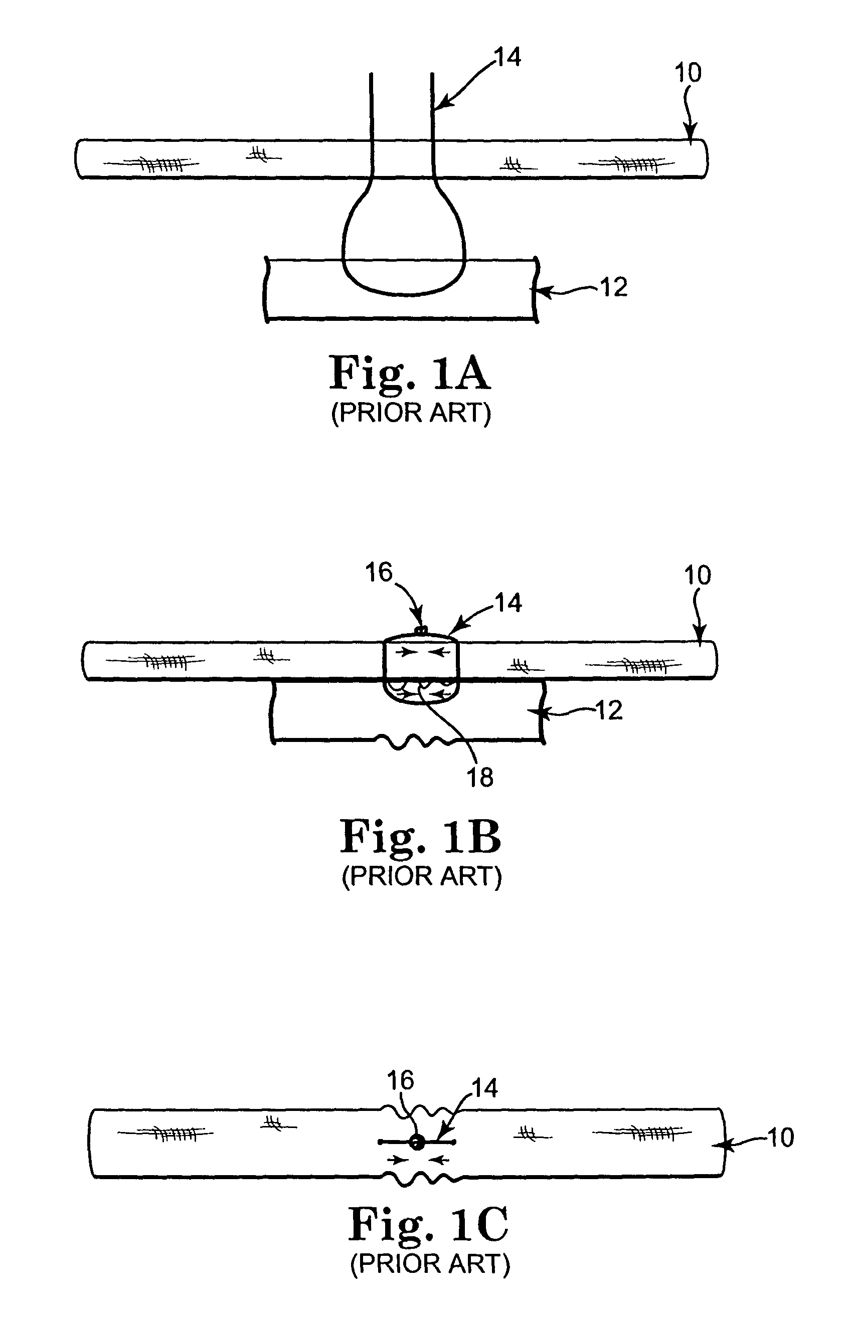 Flexible annuloplasty prosthesis