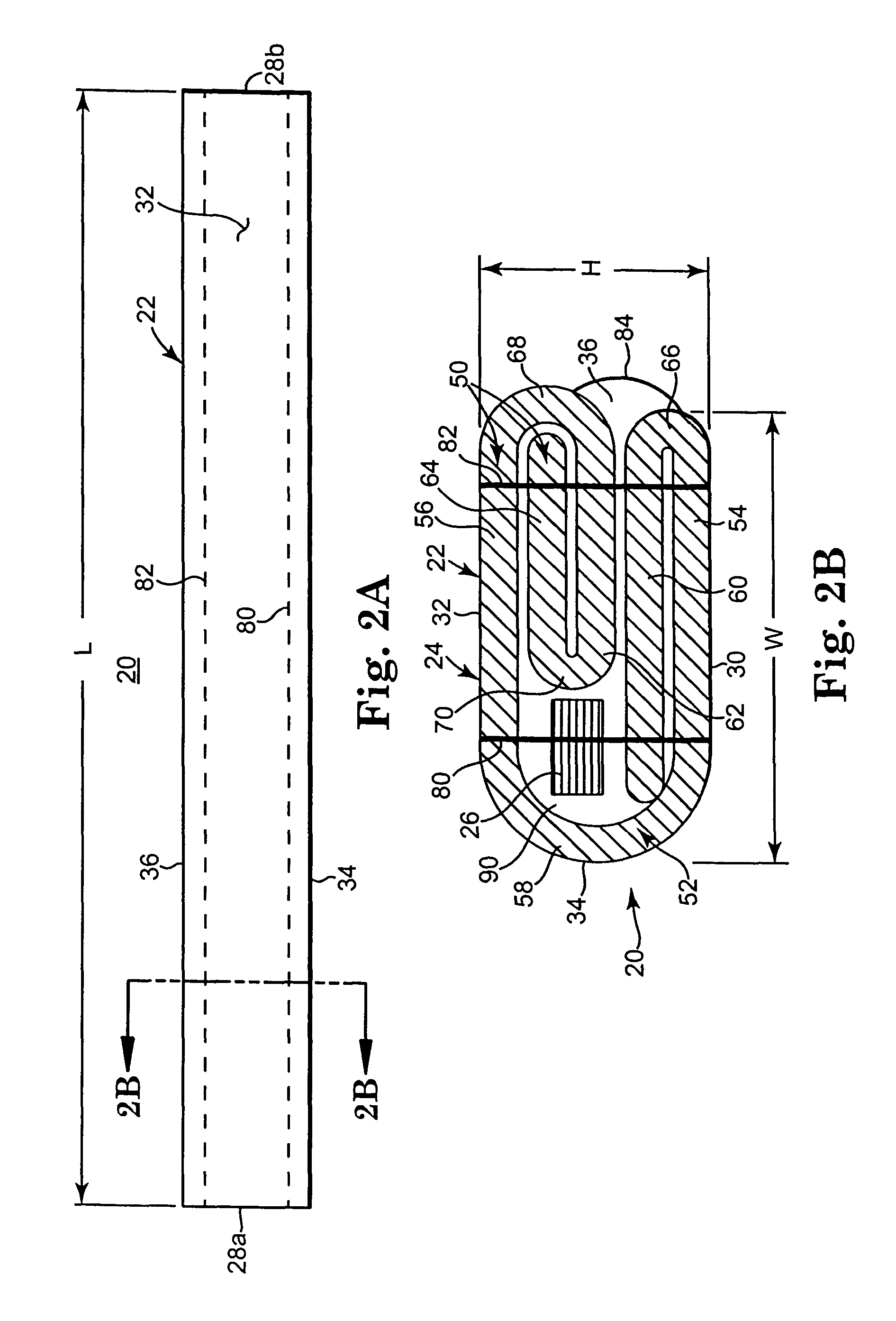 Flexible annuloplasty prosthesis