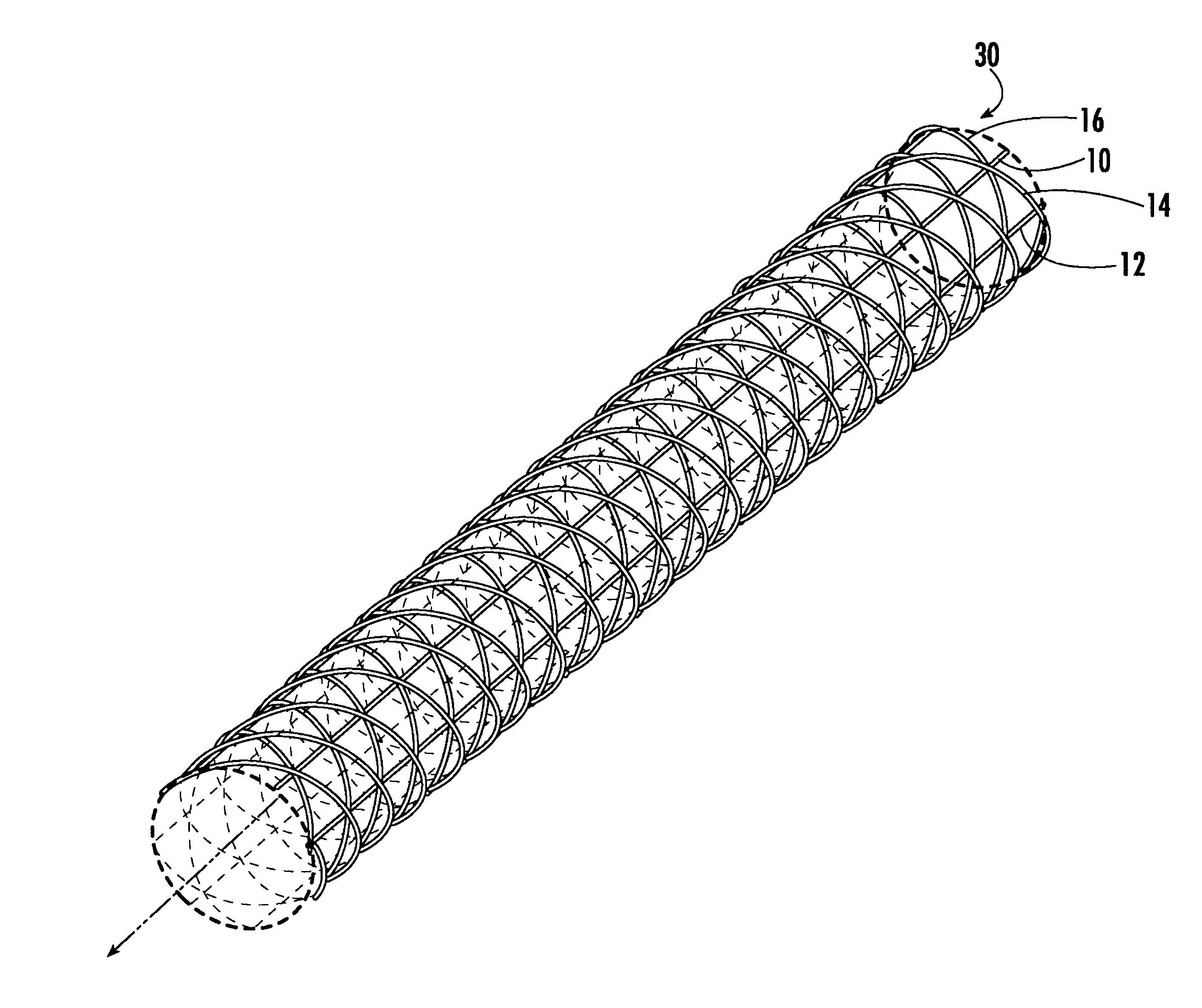 Open-lattice, foldable, self-deployable structure