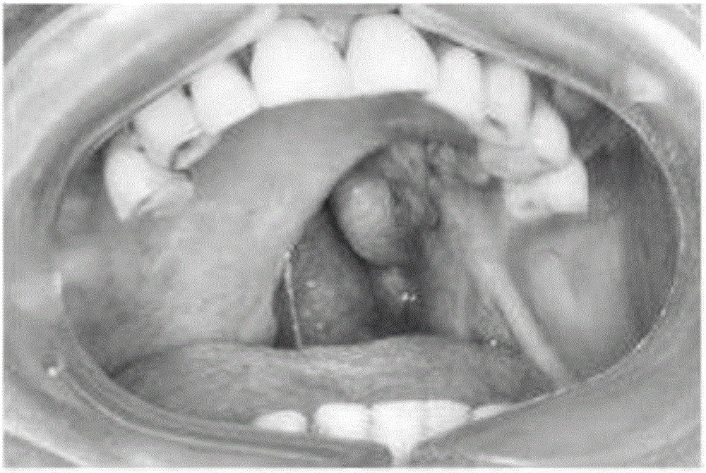 Oral-temperature shaping wax used for preparing soft palate defect cavity impression and preparation method thereof