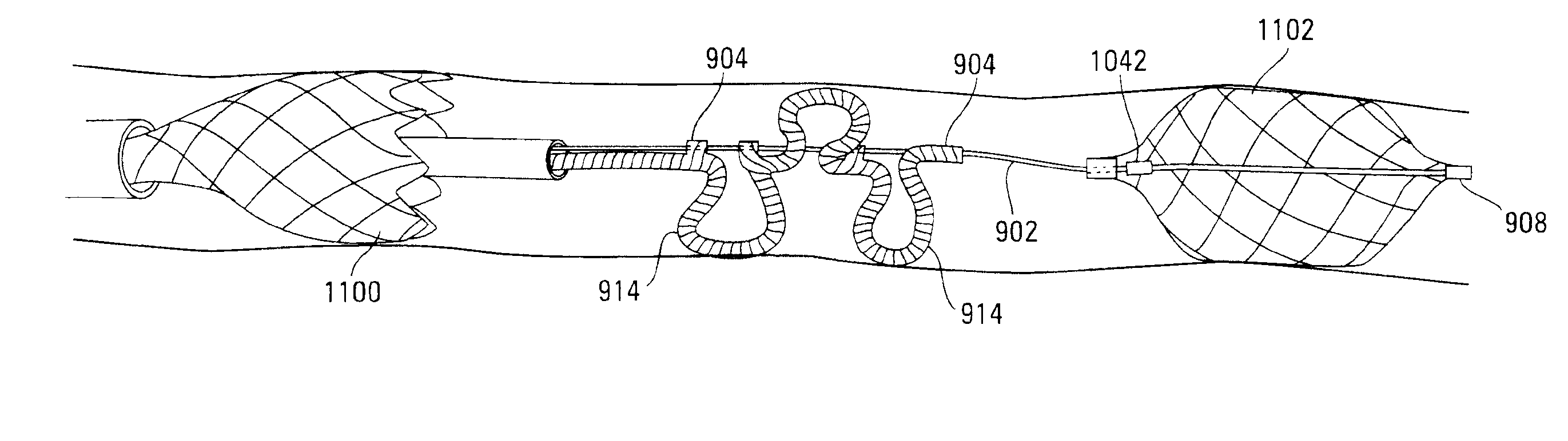 Thrombus removal system and process