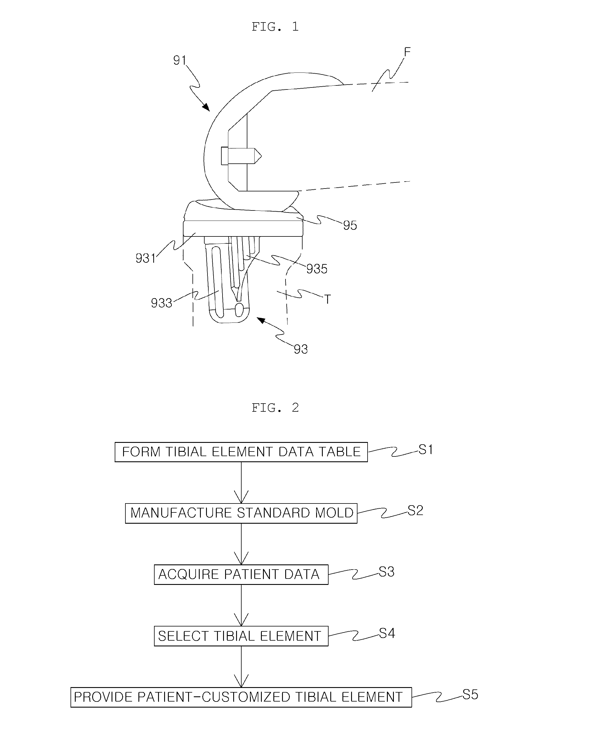 Method of Manufacturing Patient-Customized Tibial Element