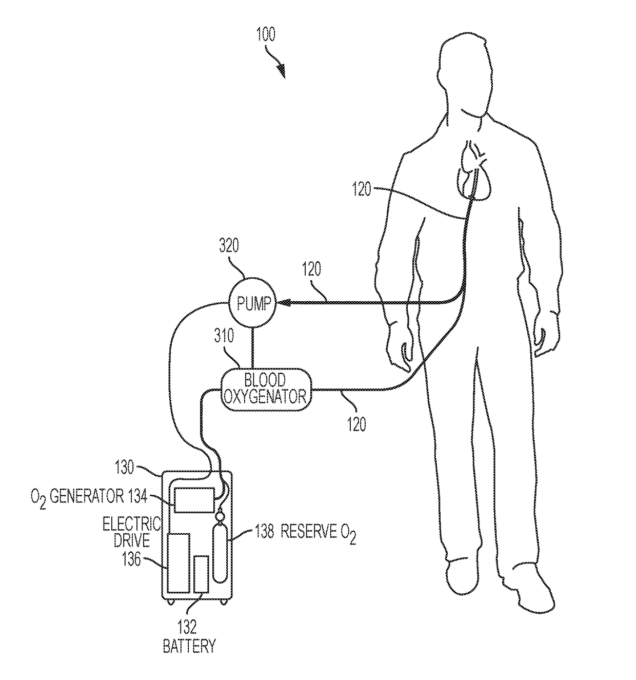 Artificial lung system and its methods of use