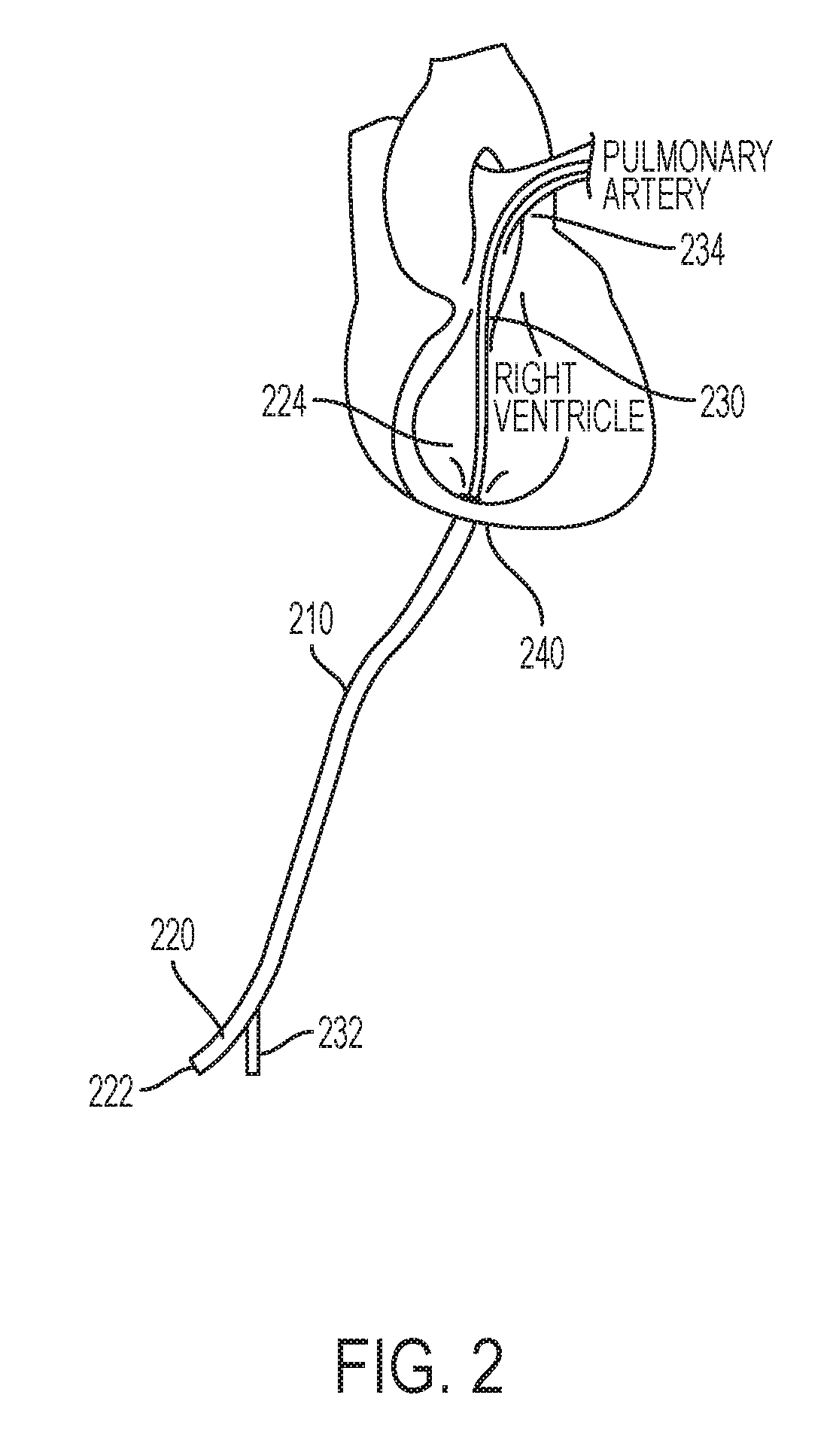 Artificial lung system and its methods of use