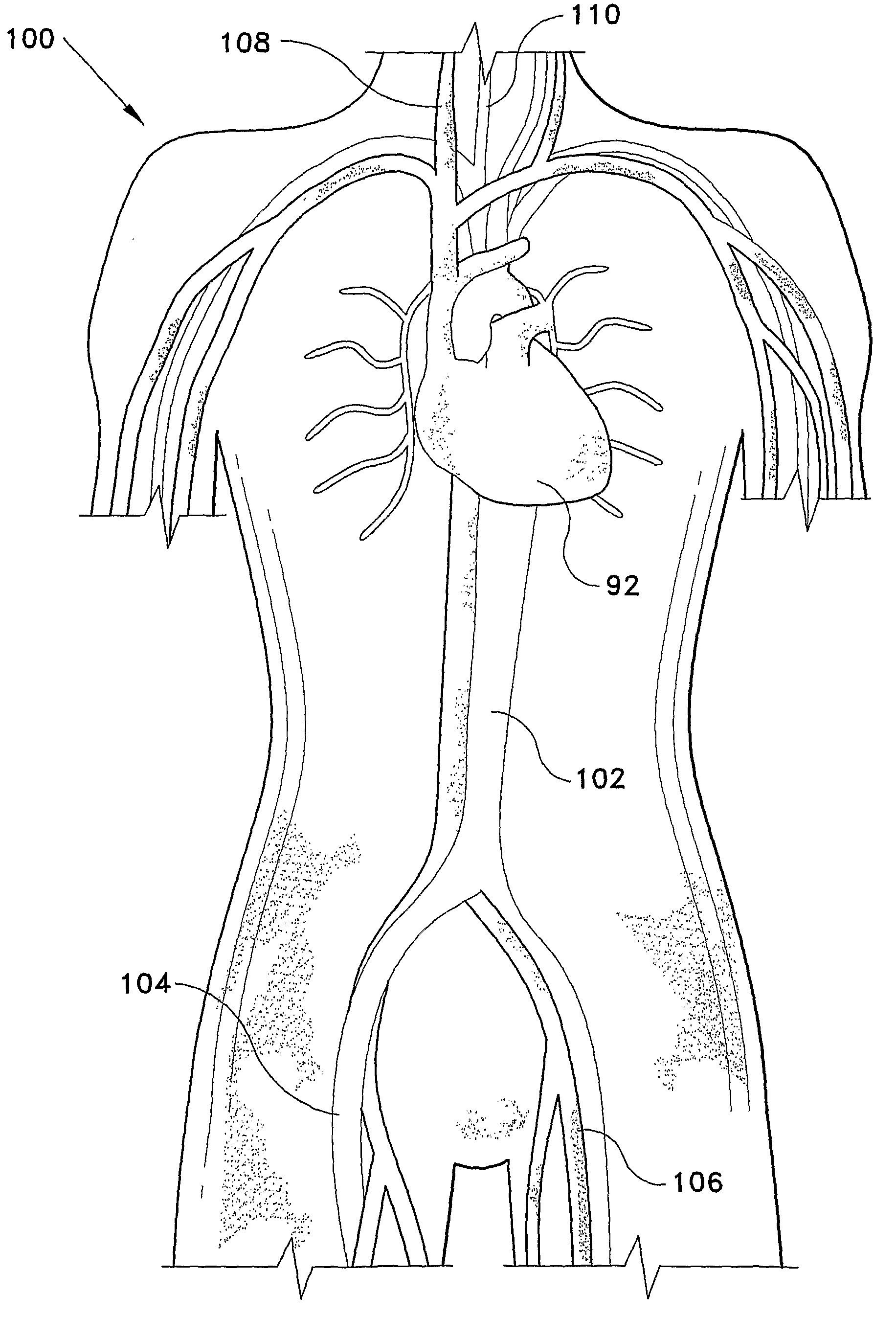 Ultrasound training mannequin