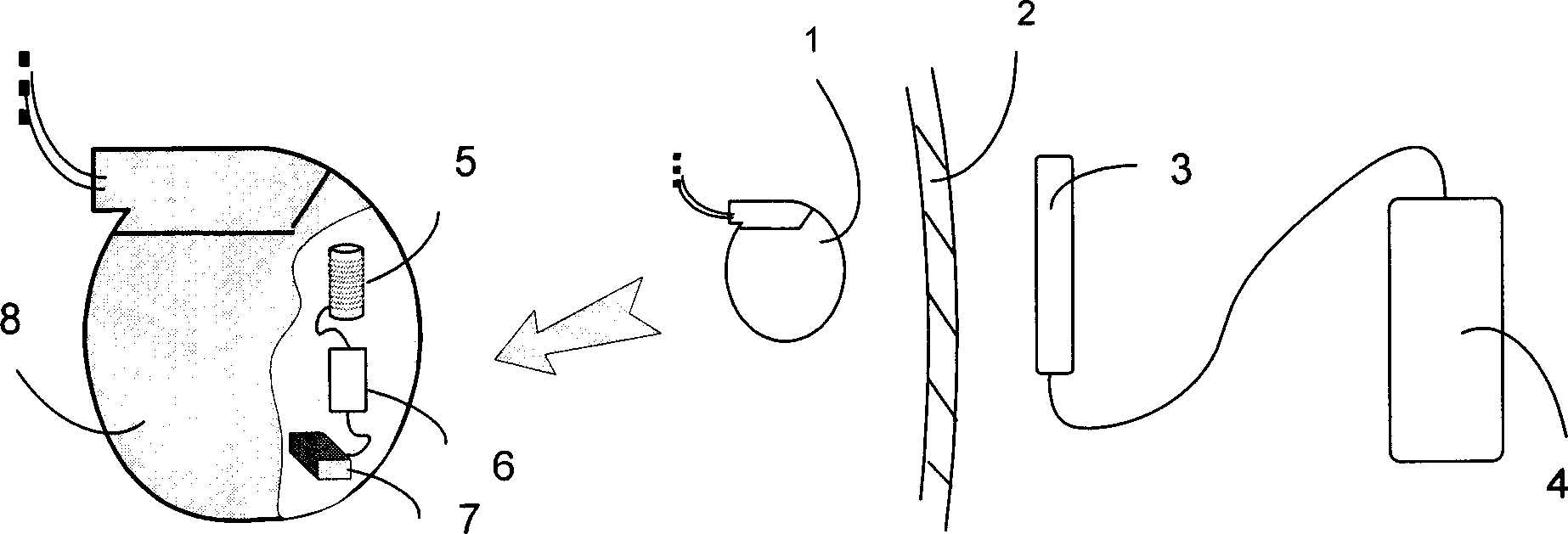 Wireless charging device through skin in use for implantation type medical treatment instrument