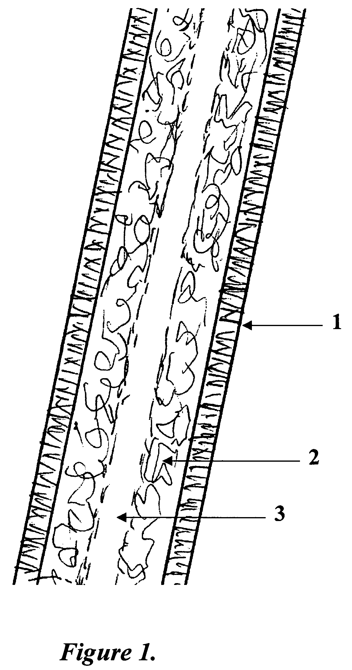 Tissue engineered biomimetic hair follicle graft