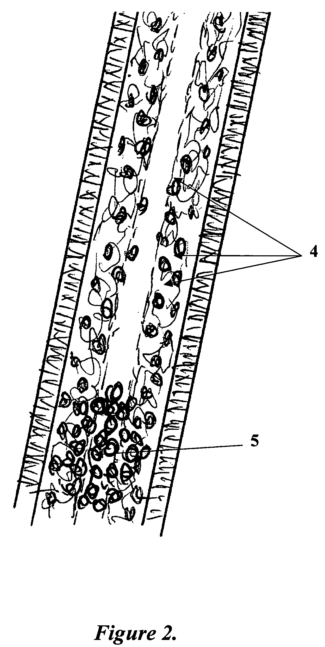 Tissue engineered biomimetic hair follicle graft