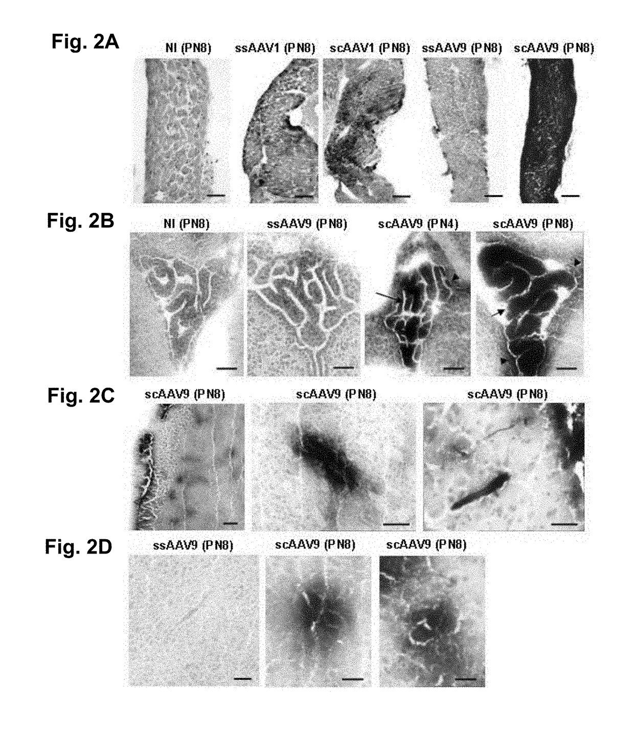 Widespread gene delivery to motor neurons using peripheral injection of aav vectors