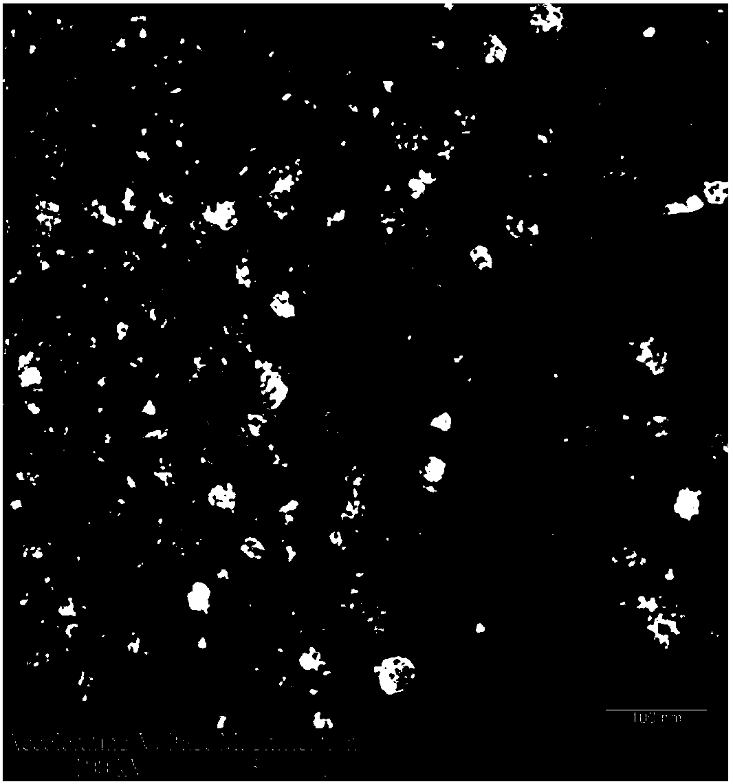 Dissoluble microneedle carrying lipidosome cis-platinum nano-particles and preparation method of dissoluble microneedle