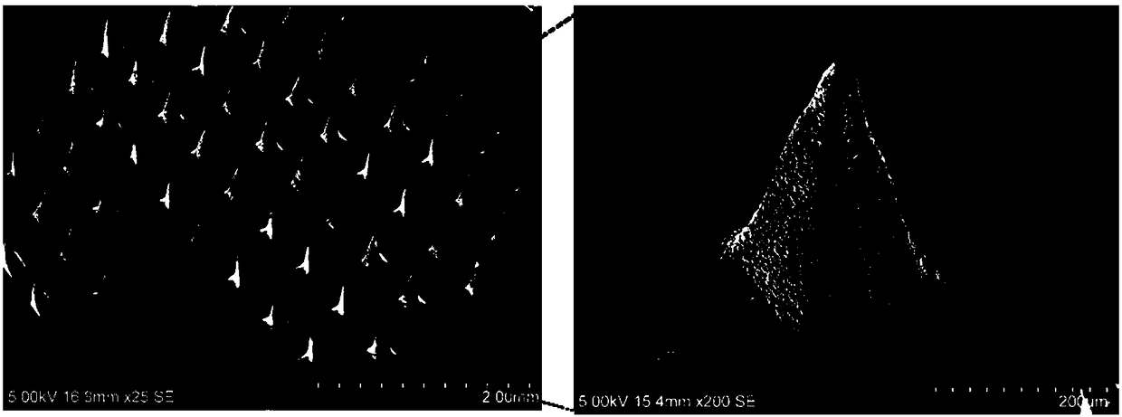 Dissoluble microneedle carrying lipidosome cis-platinum nano-particles and preparation method of dissoluble microneedle