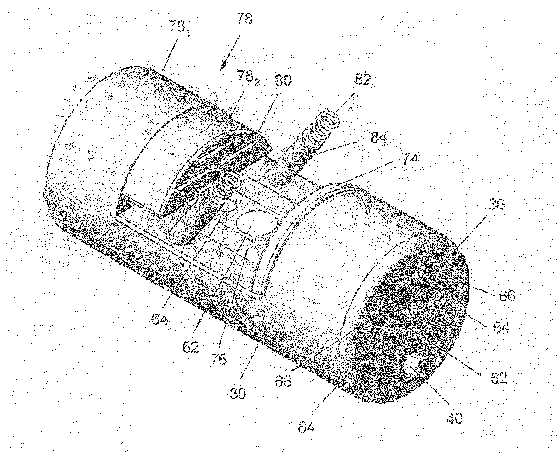 Devices and methods for treating morbid obesity