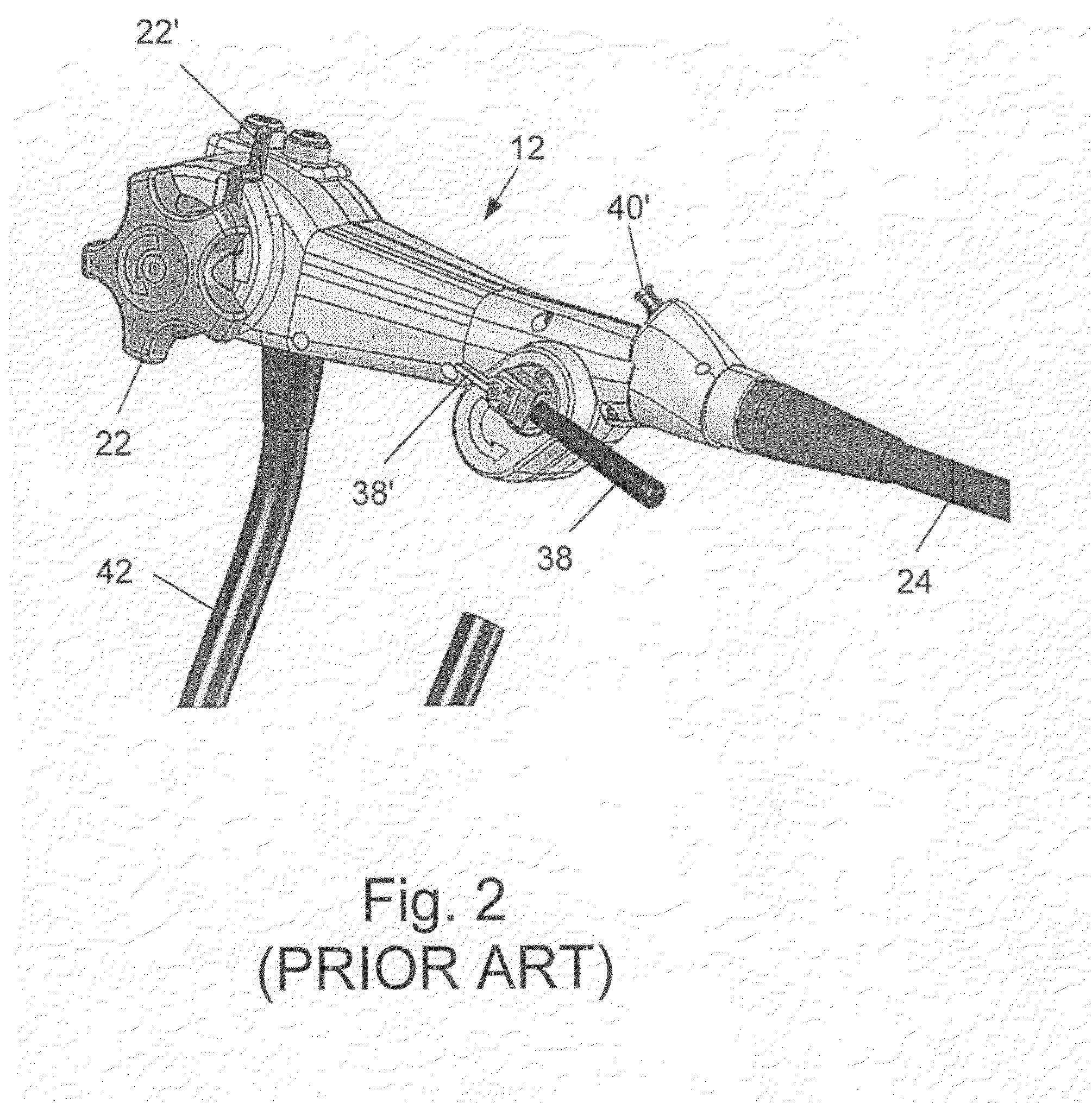 Devices and methods for treating morbid obesity