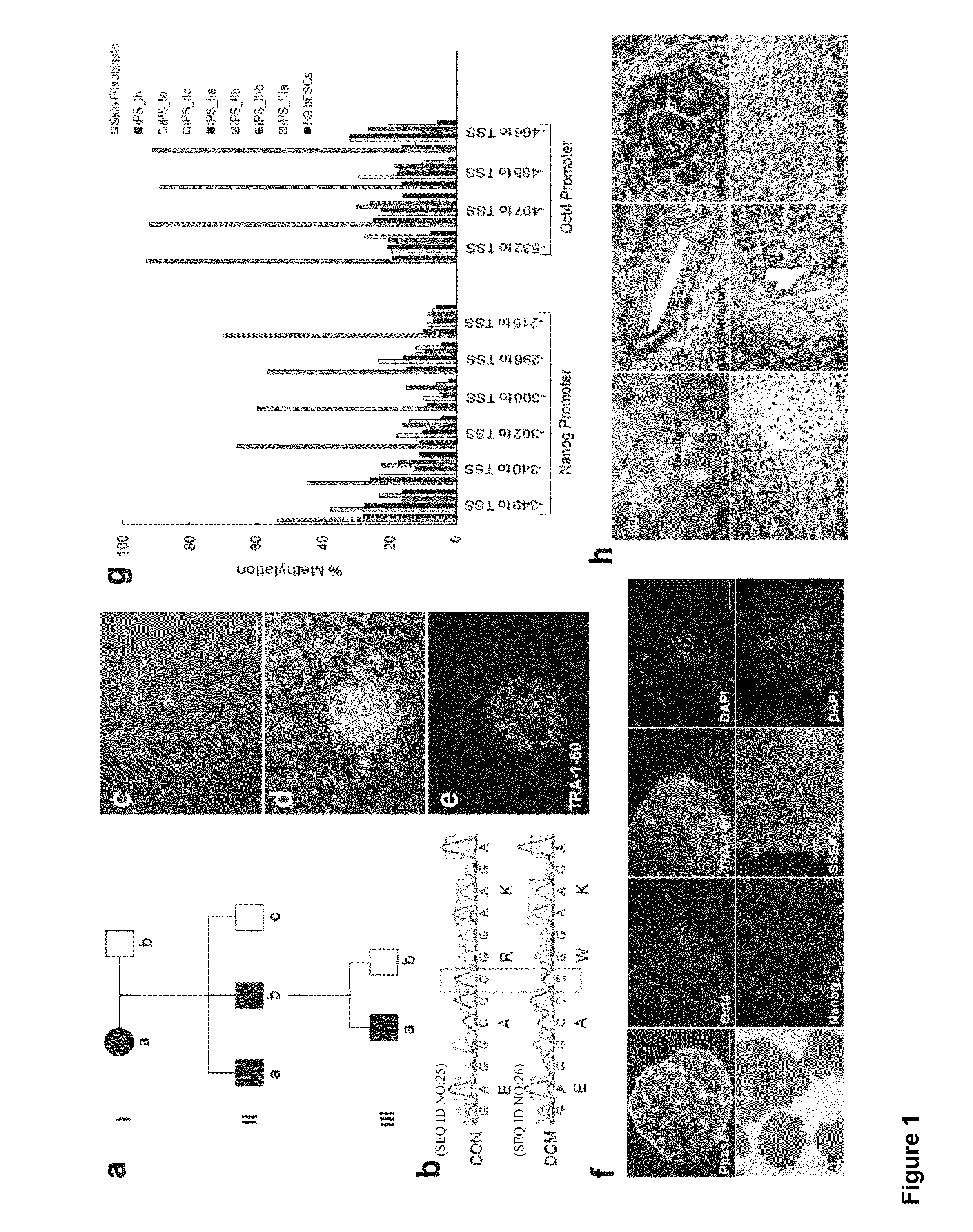 Cardiomyocytes from induced pluripotent stem cells from patients and methods of use thereof