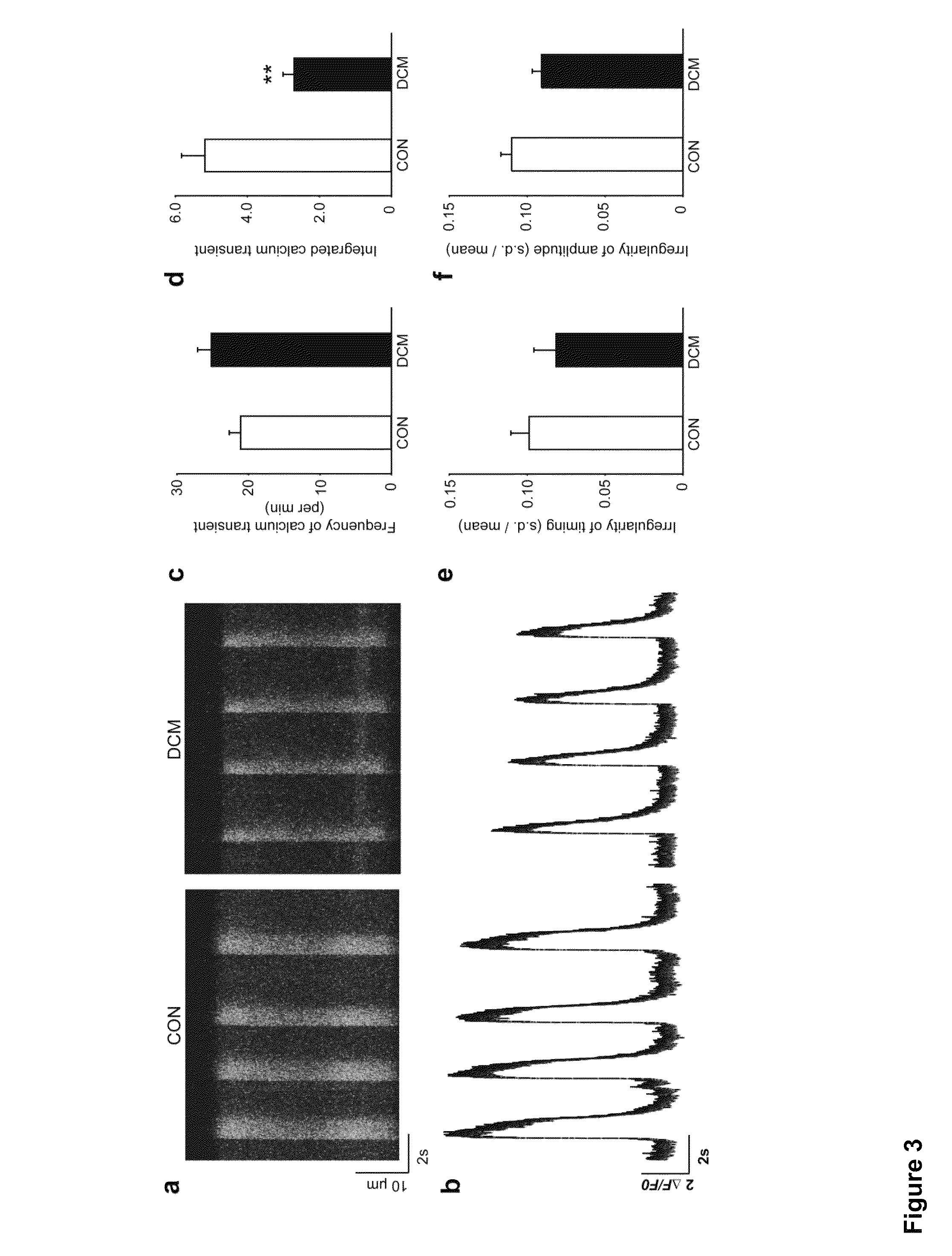 Cardiomyocytes from induced pluripotent stem cells from patients and methods of use thereof