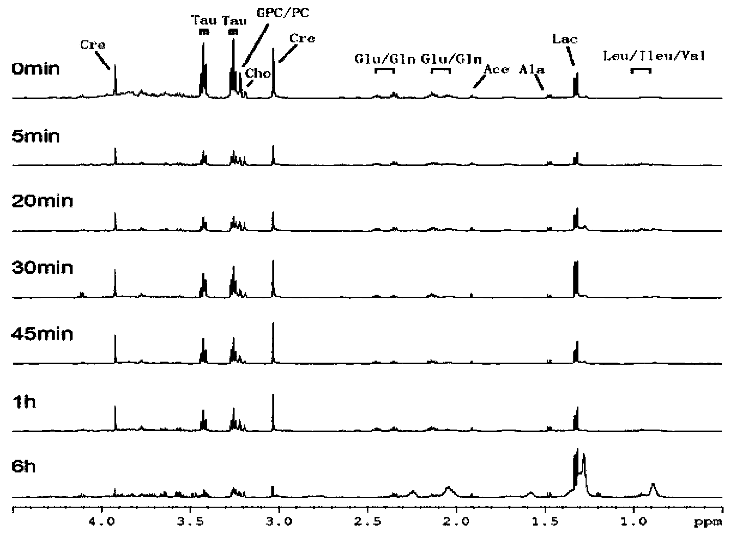 Application of taurine in preparing preparation for detecting or preventing myocardial ischemia injury