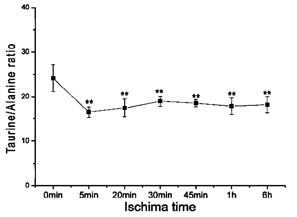 Application of taurine in preparing preparation for detecting or preventing myocardial ischemia injury