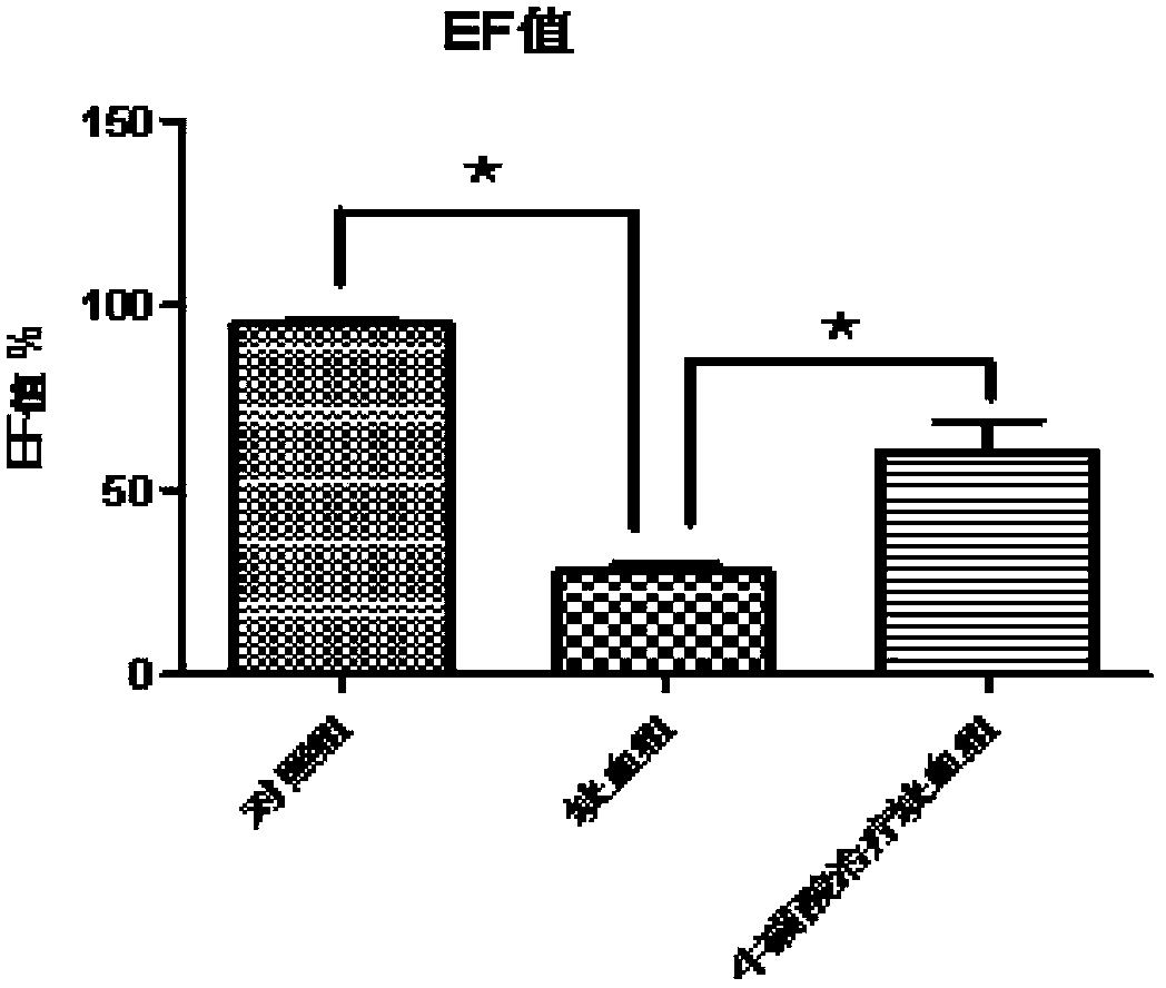 Application of taurine in preparing preparation for detecting or preventing myocardial ischemia injury