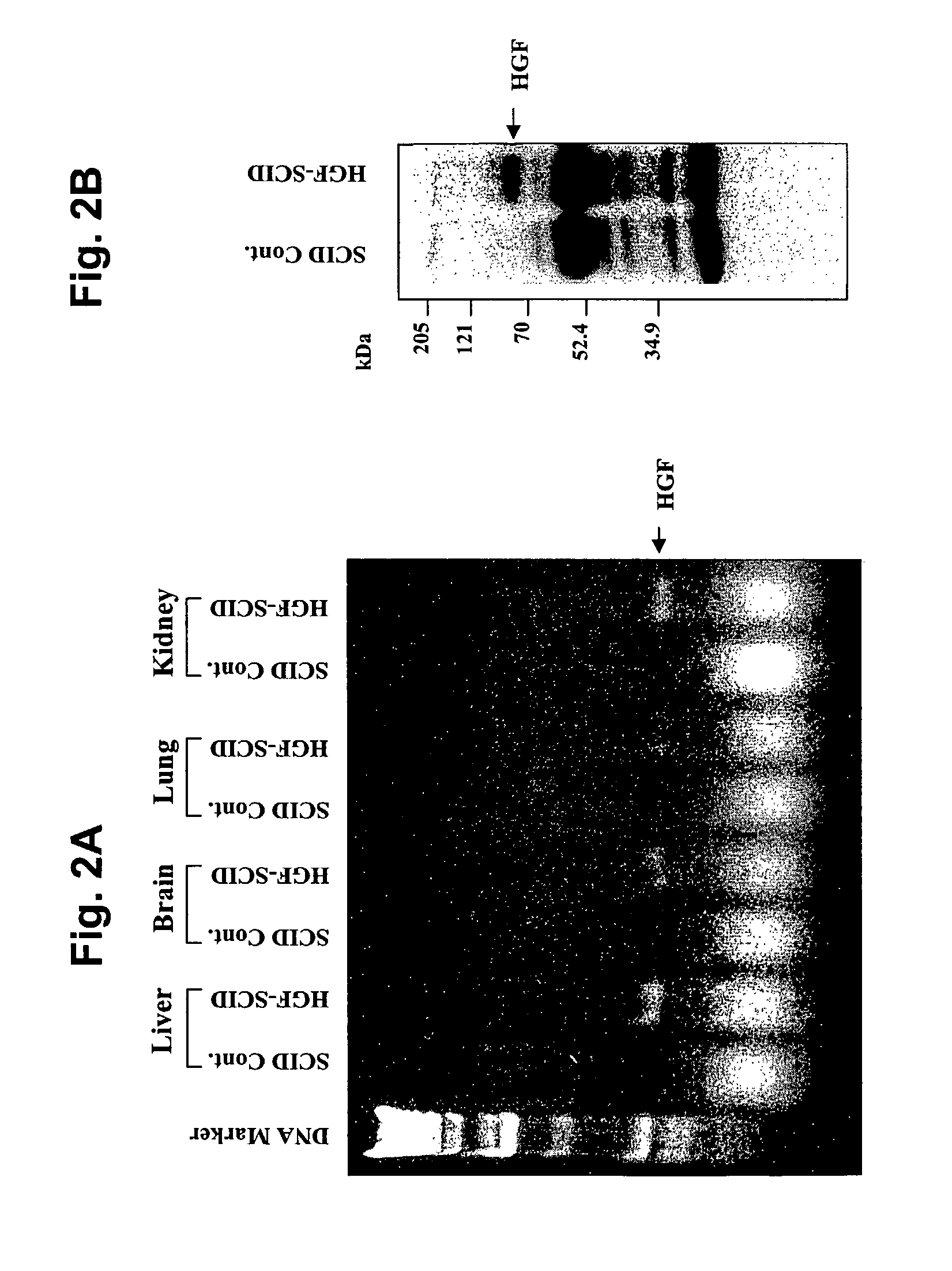 Immune-compromised transgenic mice expressing human hepatocyte growth factor (hHGF)