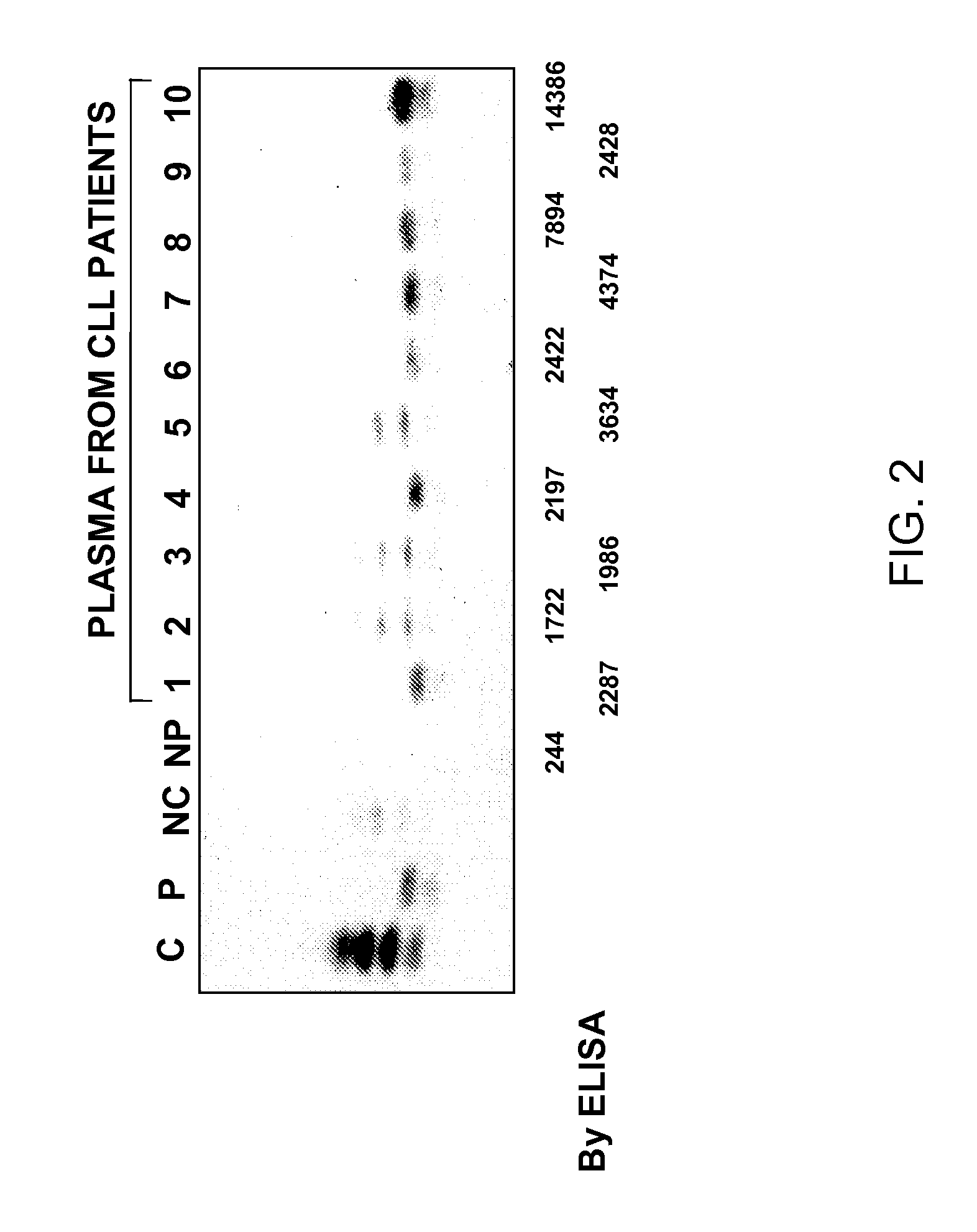 Measuring circulating therapeutic antibody, antigen and antigen/antibody complexes using ELISA assays