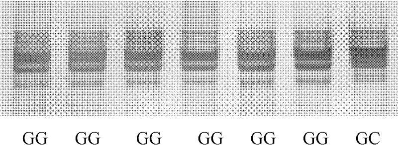 Method for detecting ox FTO (Fat Mass and Obesity-associated) gene single nucleotide polymorphism (SNP)