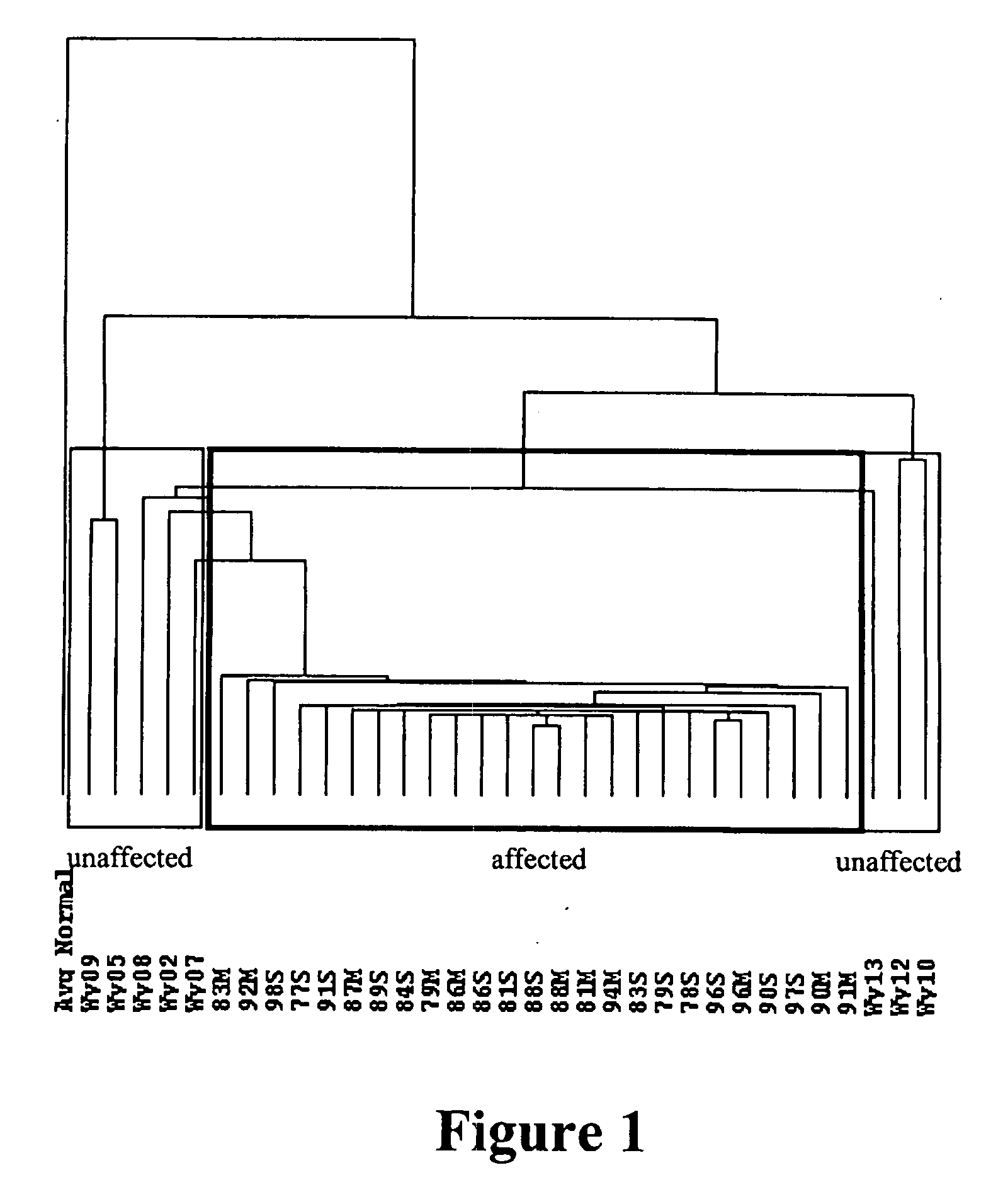 Nucleic acid arrays for detecting gene expression associated with human osteoarthritis and human proteases