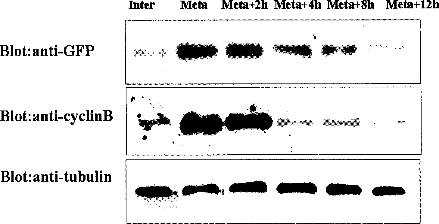 Use of CENP-E binding protein and its coding gene in preparing medicine for suppressing tumor proliferation