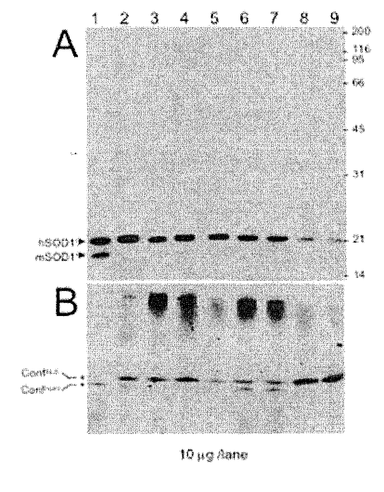 Biomarkers for als