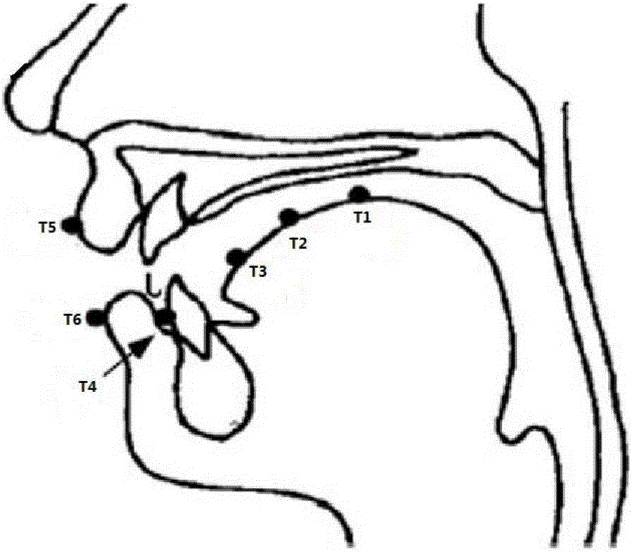 Dysarthrosis detection method and dysarthrosis detection system