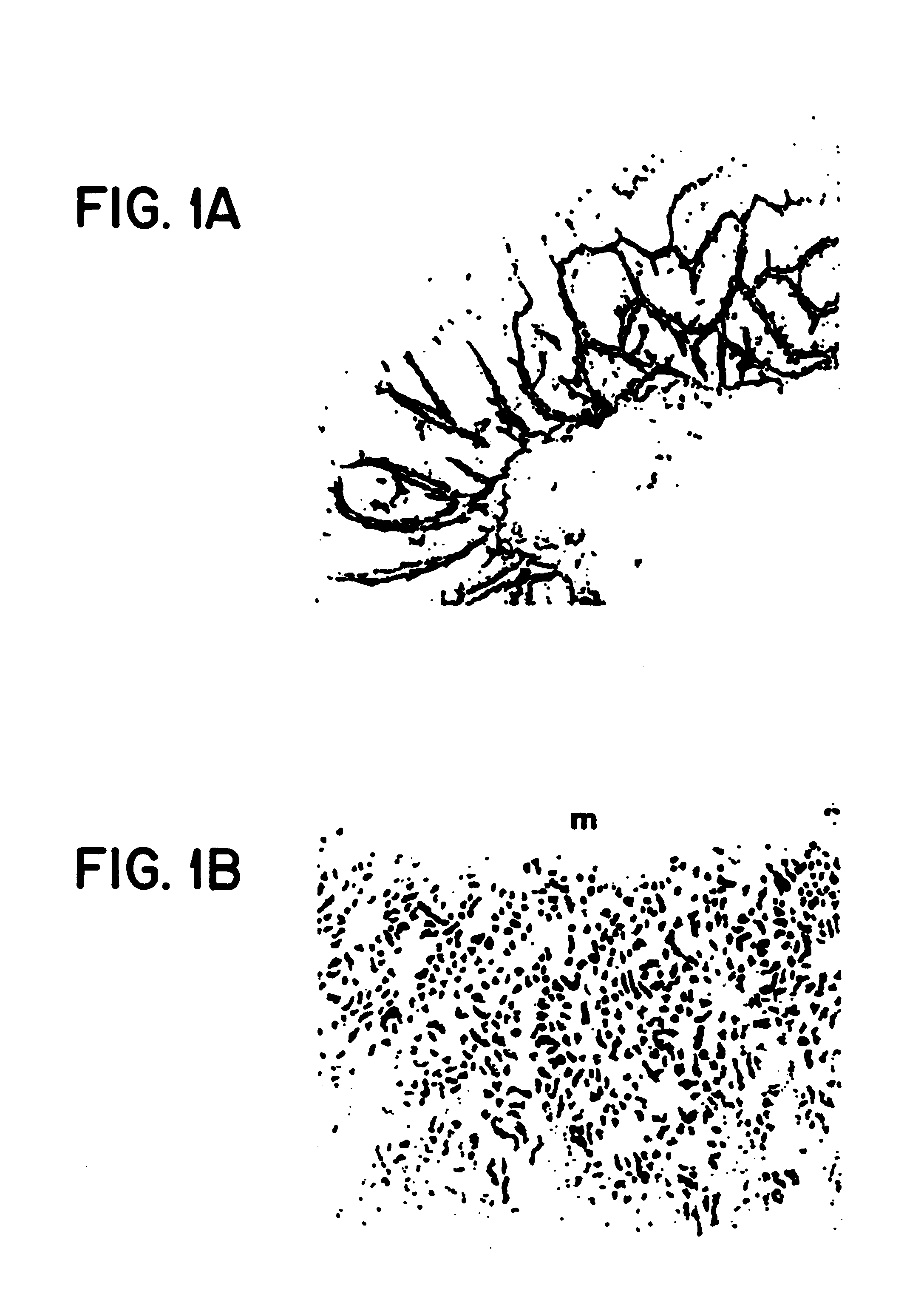 Method of dephosphorylating an endotoxin in vivo with alkaline phosphatase