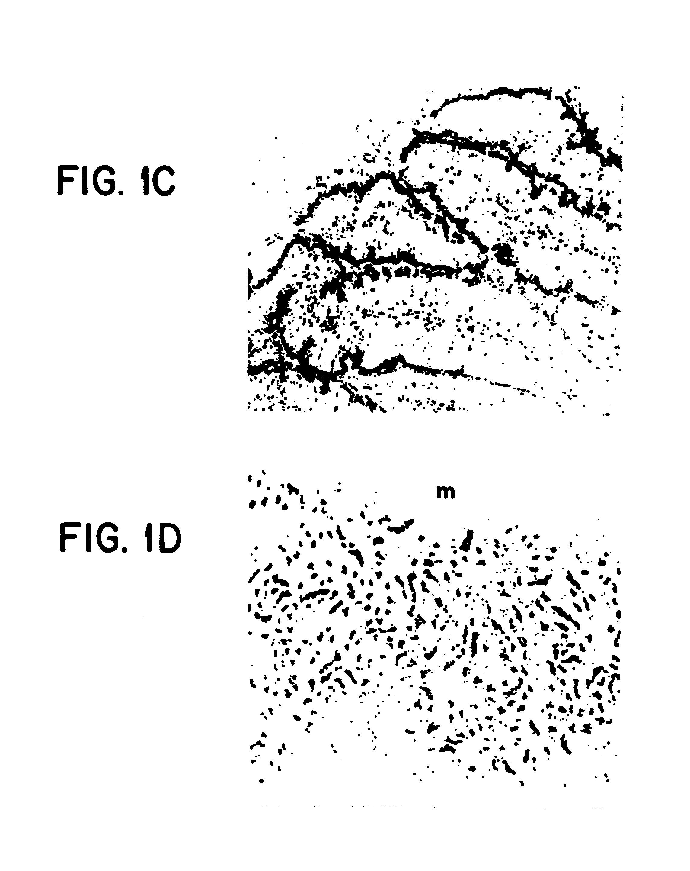 Method of dephosphorylating an endotoxin in vivo with alkaline phosphatase