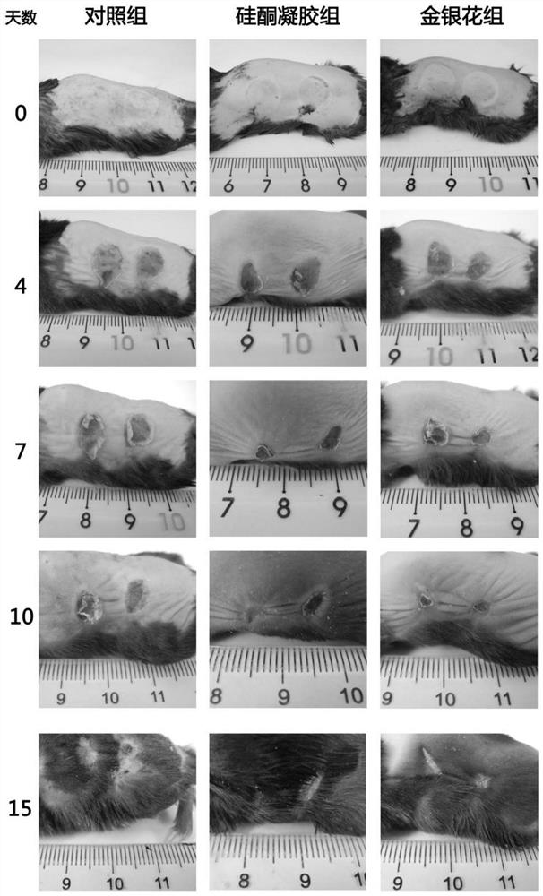 Preparation method of honeysuckle flower extract and application of honeysuckle flower extract in preparation of medicine for preventing or treating scars of burnt or scalded skin