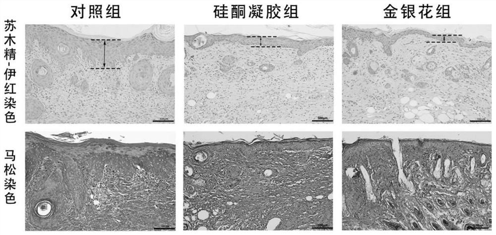 Preparation method of honeysuckle flower extract and application of honeysuckle flower extract in preparation of medicine for preventing or treating scars of burnt or scalded skin