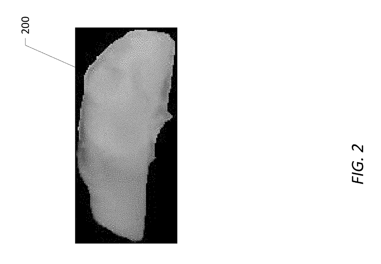 Nanosilica dispersion lost circulation material (LCM)