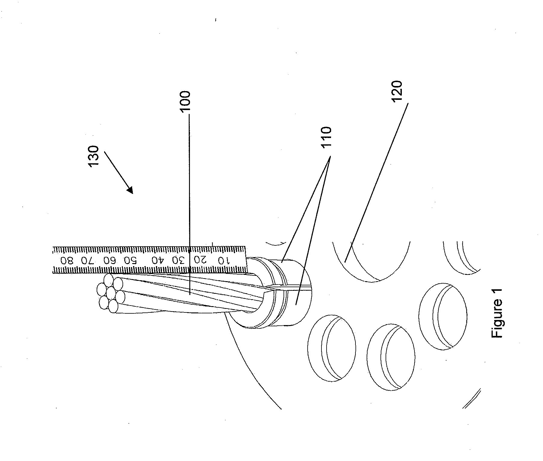 Anchorage system