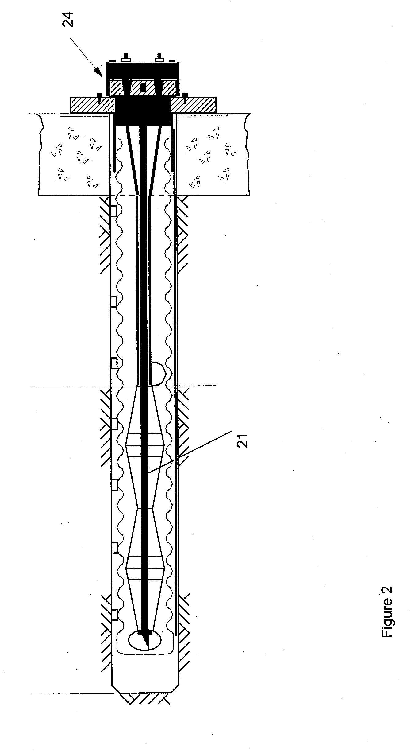 Anchorage system