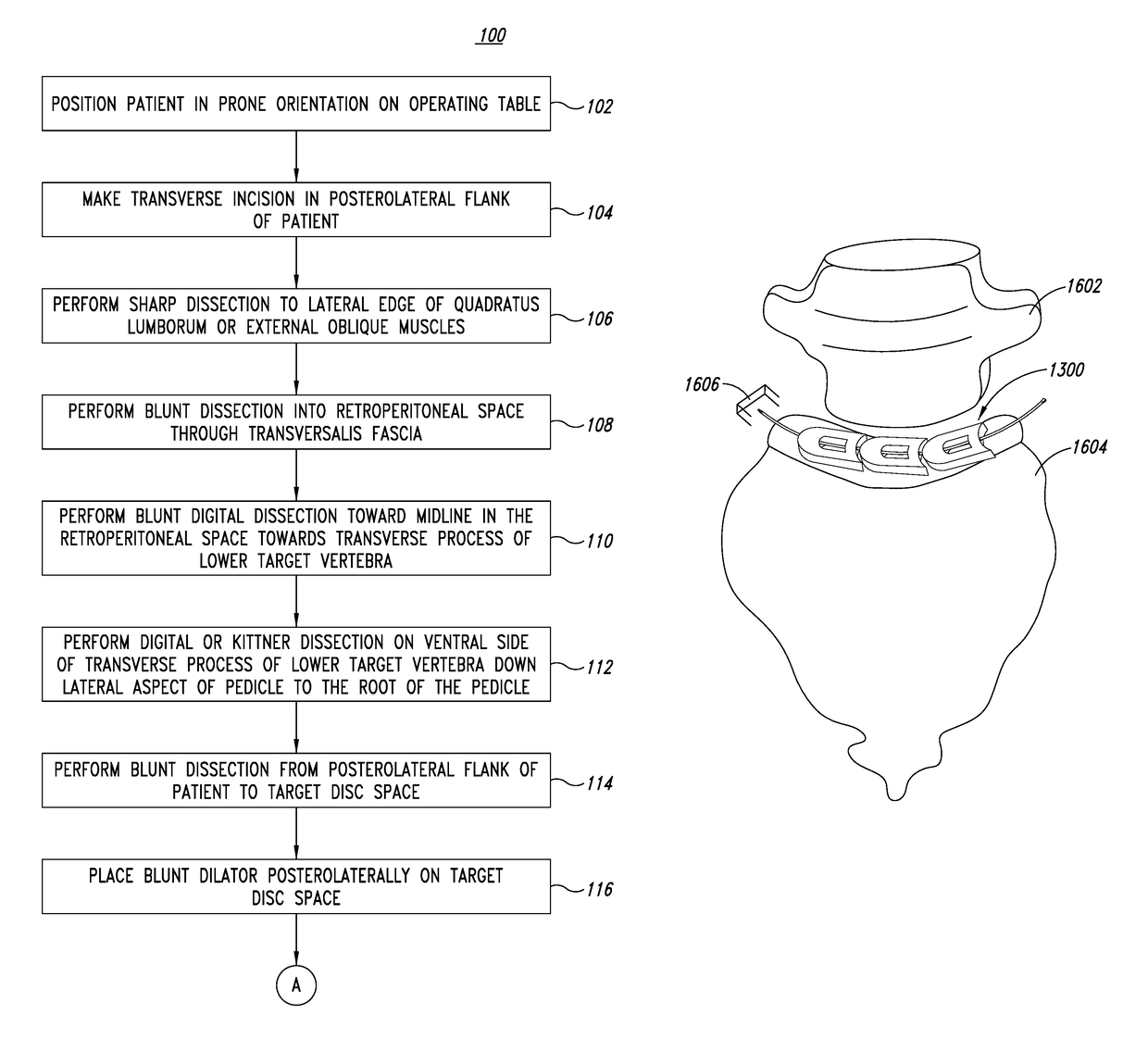 Devices and approach for prone intervertebral implant