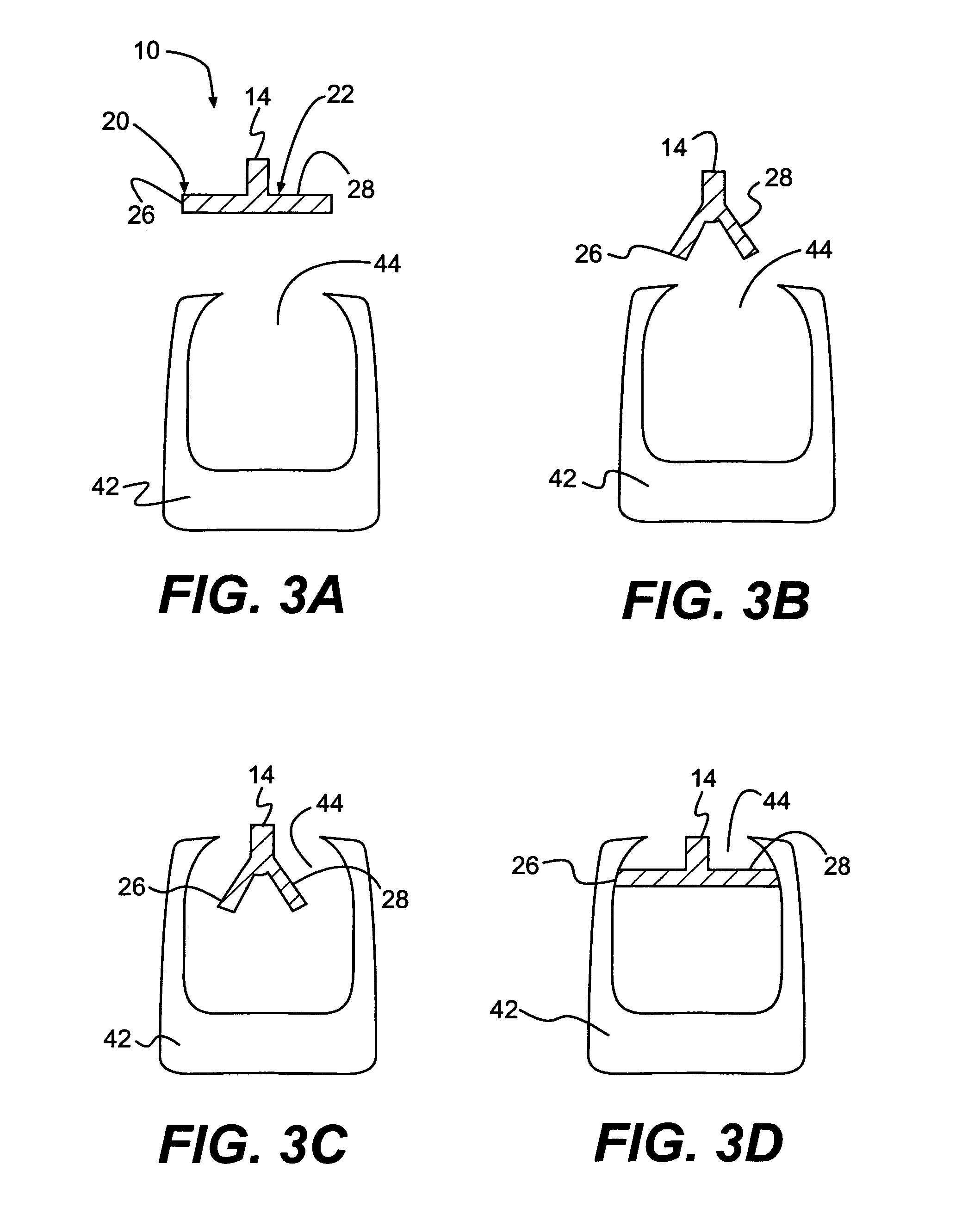 Method and apparatus for enhanced delivery of treatment device to the intervertebral disc annulus