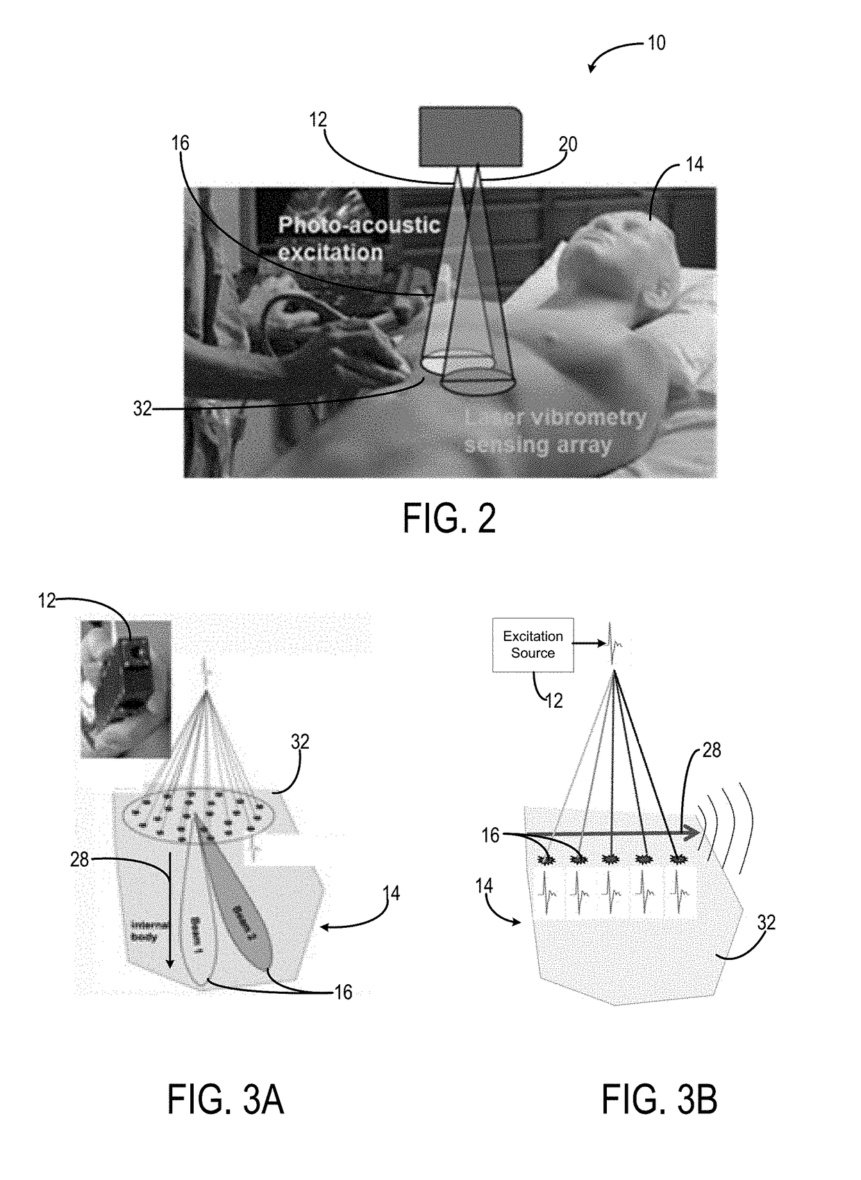 System and method for non-contact ultrasound with enhanced safety