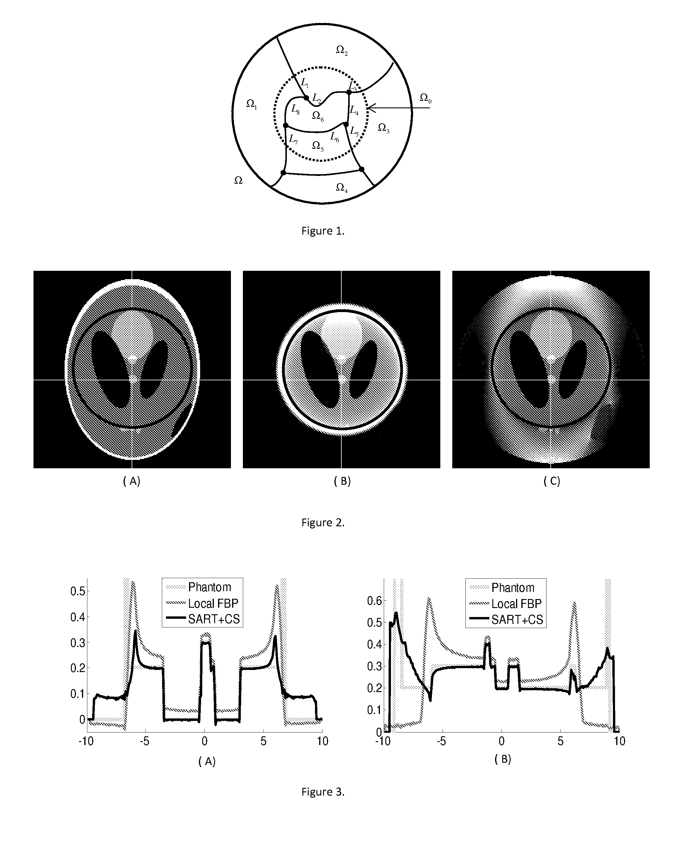 Exact local computed tomography based on compressive sampling