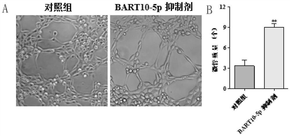 Application of Epstein-Barr virus mir-bart10-5p inhibitor