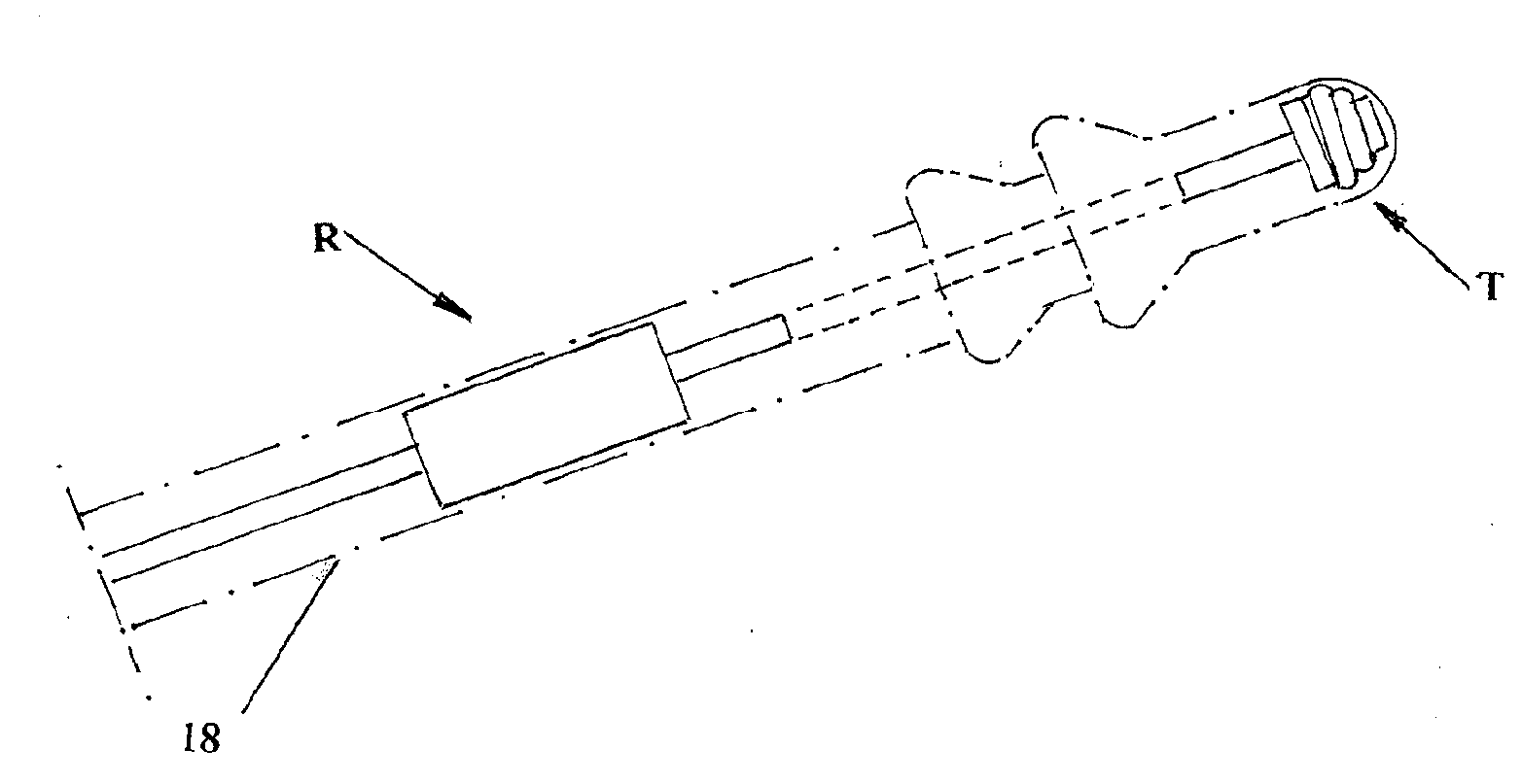 Redundant pacing system with leaded and leadless pacing