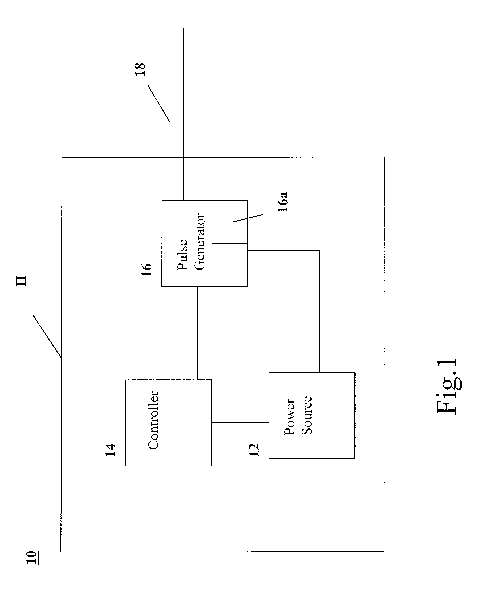 Redundant pacing system with leaded and leadless pacing