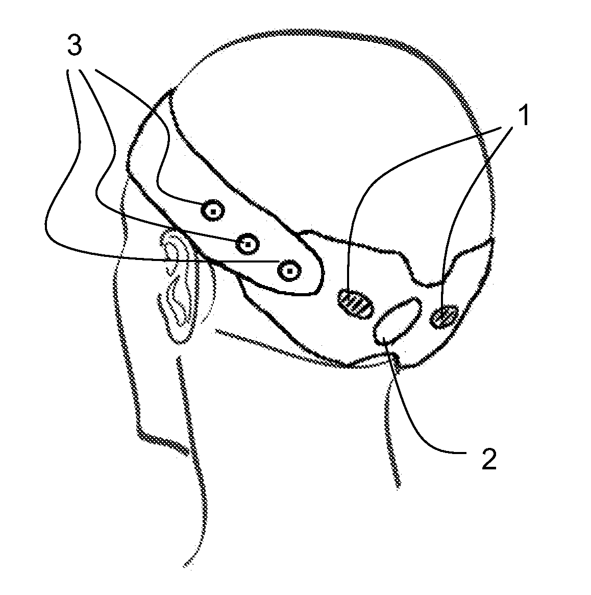 Headband for External Occipital Neurostimulation