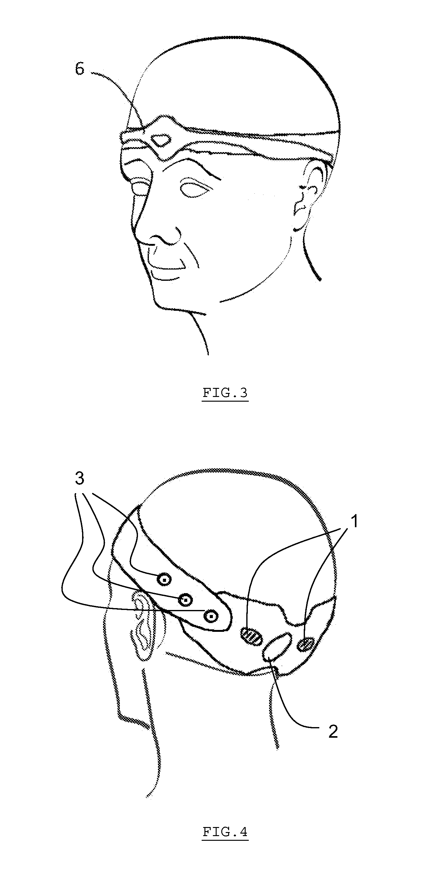 Headband for External Occipital Neurostimulation