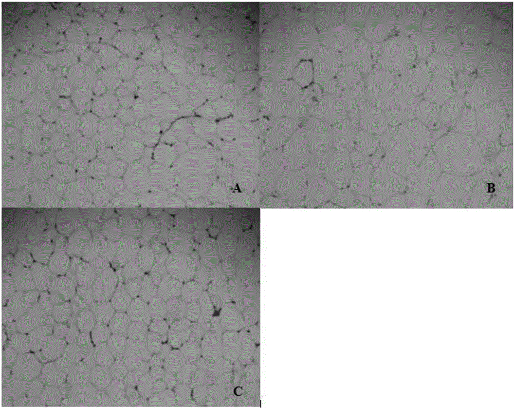 Hyperglycosylated Extendin-4, fusion protein of analogue thereof, and preparation method and application of fusion protein